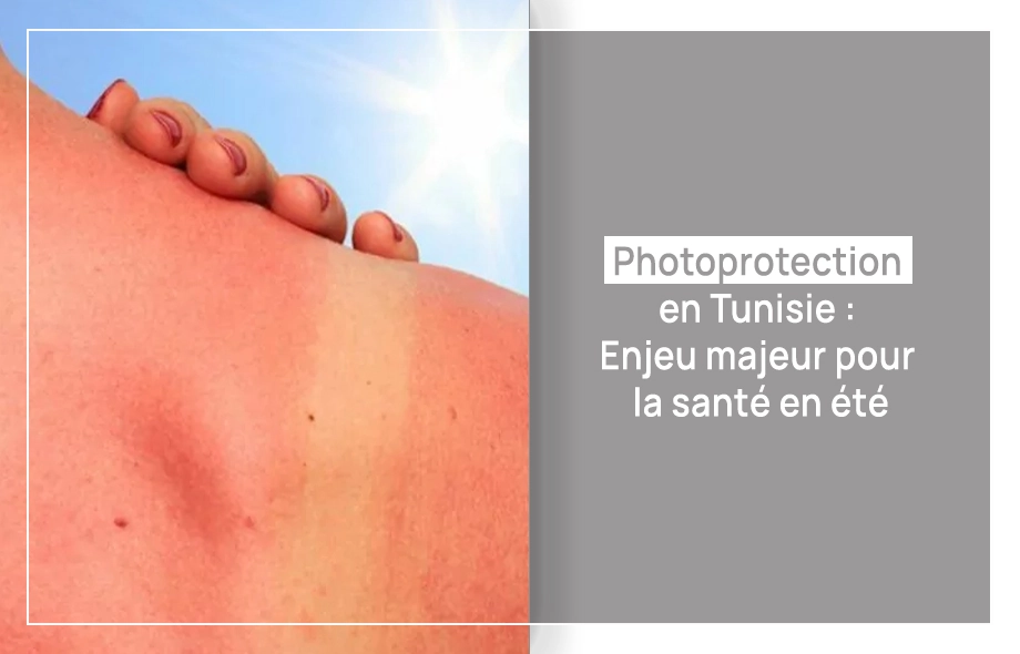 Photoprotection en Tunisie